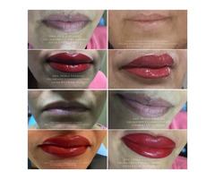 Delineado de Labios, relleno de Labios, sombreado de labios, correcciones SIN DOLOR